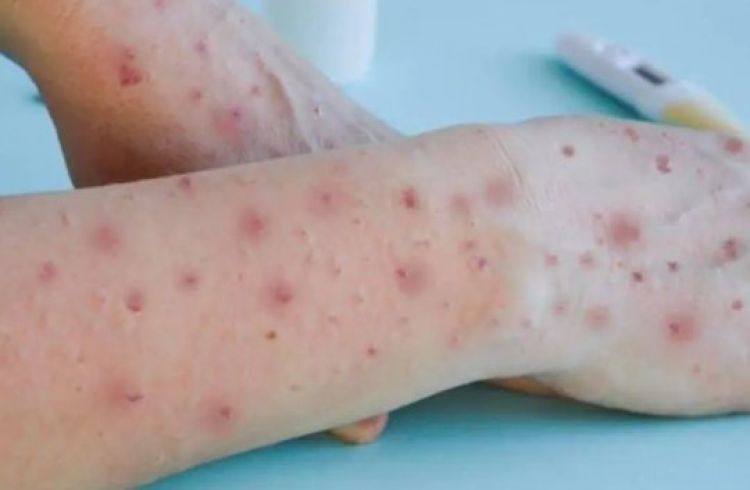 Fonte: G1.  Foto: Istock