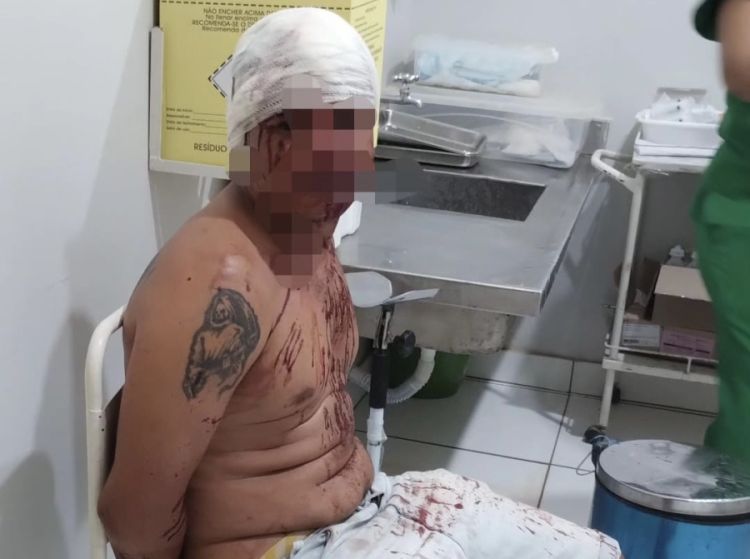 Foto: Divulgação/GPM