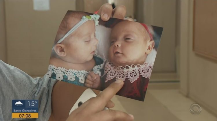 As gêmeas Ágata e Agnes — Foto: Reprodução/RBS TV