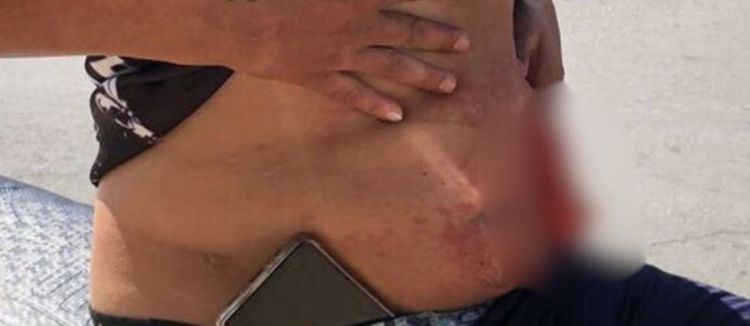 Homem fica ferido após briga em bar - Foto: Reproduções 