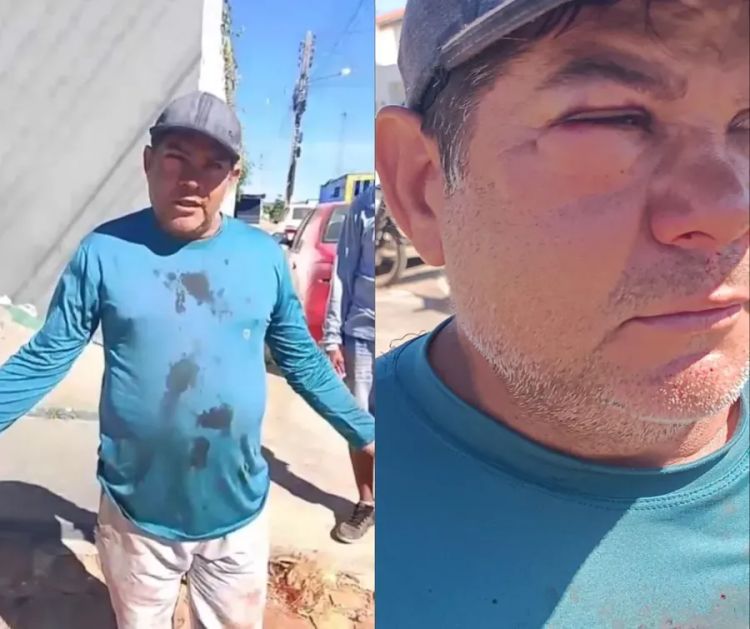 Servidor da prefeitura de São Raimundo Nonato relata ter sido agredido enquanto recolhia vacas na rua — Foto: Reprodução