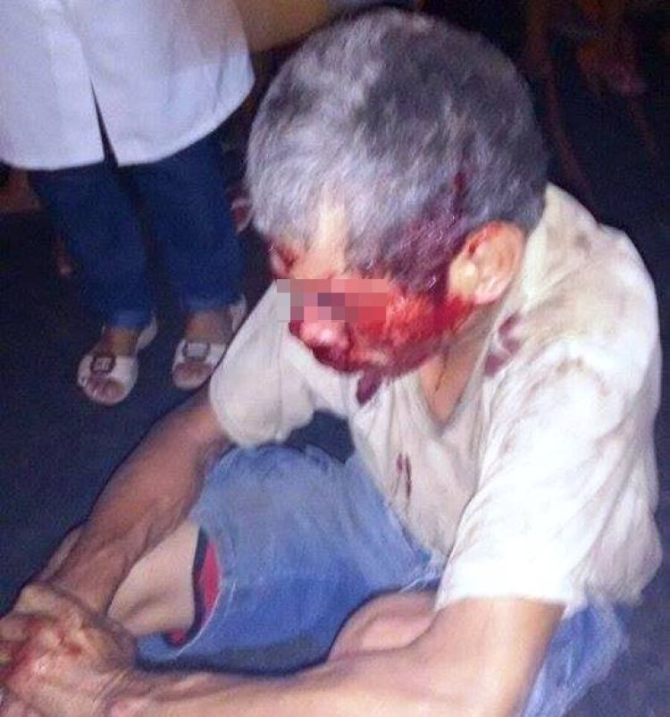 A vítima 2º caso caiu de sua moto depois de colidir com um andarilho. 