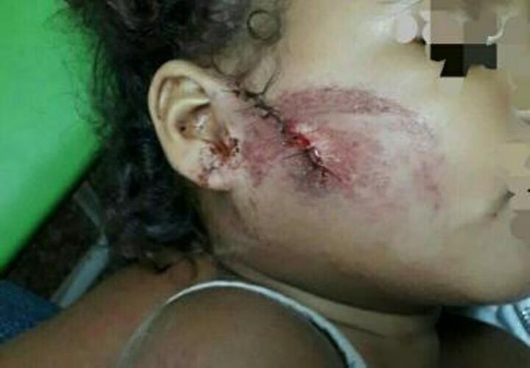 Fonte: G1. Foto: cliqueuniao