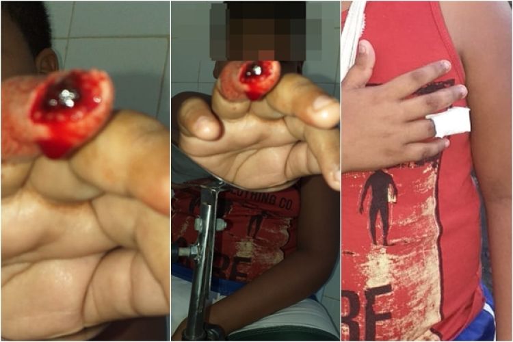 Fonte: Barras é notícia